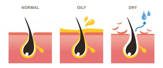 KNOW YOUR SKIN TYPE BETTER